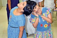 London doctors examined conjoined twins veena vani