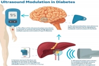 Treating diabetes without drugs novel non pharmacologic treatments on the horizon