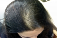 The healthy beauty tips to reduce hair loss problems food items